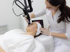 Лазерная шлифовка рубцов при постакне